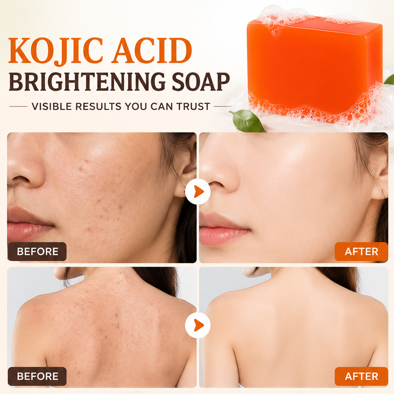 Sabun Asam Kojic 6 Buah, Mence - Soap Making Glycerin ulasan dan harga